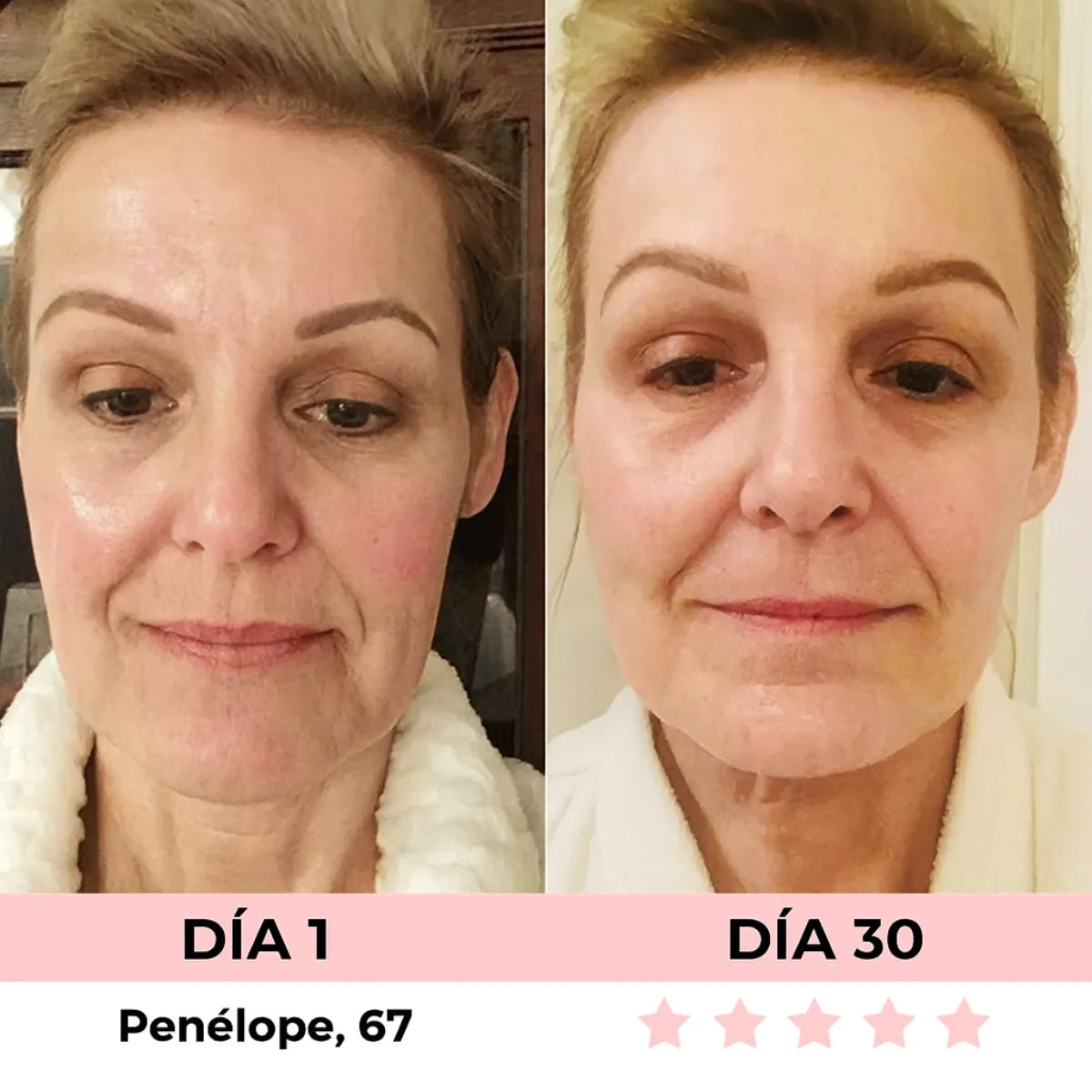 VitaGlow - Escultor Facial LED 7-in-1