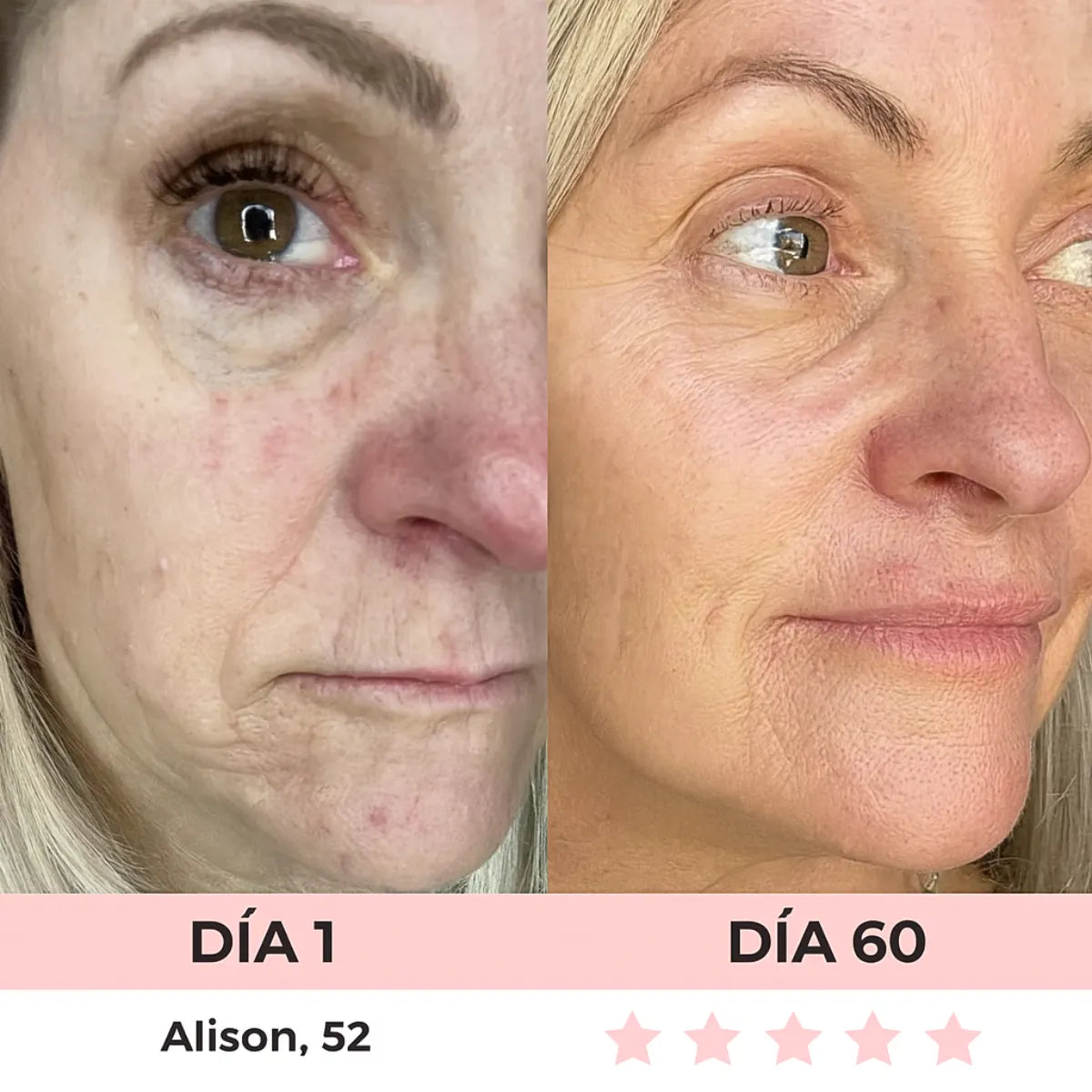 VitaGlow - Escultor Facial LED 7-in-1