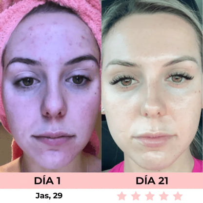 VitaGlow - Escultor Facial LED 7-in-1