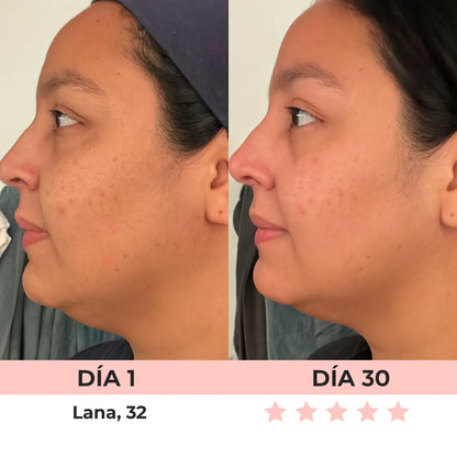 VitaGlow - Escultor Facial LED 7-in-1