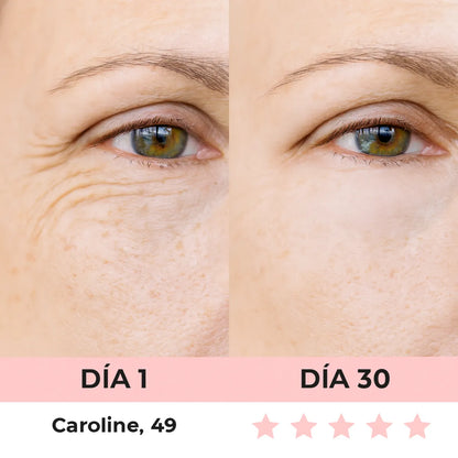 VitaGlow - Escultor Facial LED 7-in-1