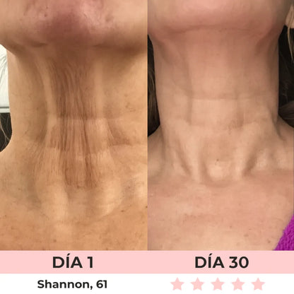 VitaGlow - Escultor Facial LED 7-in-1